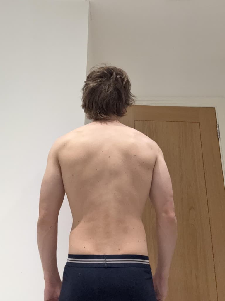 back progress photo